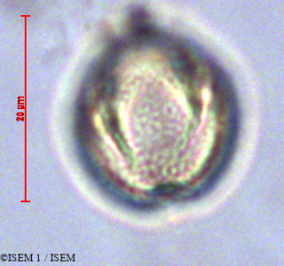 ISEM 1/Phyllanthus_amarus_28489/Phyllanthus_amarus_28489_0001(copy)_thumb.jpg